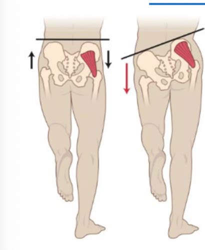 MSK II Lumbar Spine Exam Assessment Flashcards Quizlet