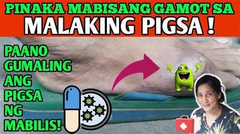 Gamot Sa Pigsa Upang Mabilis Na Mawala Ang Malaking Pigsa