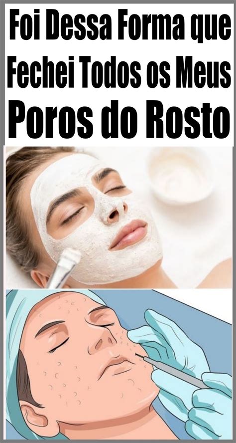 Como Fechar Os Poros Do Rosto Definitivamente Em 4 Minutos