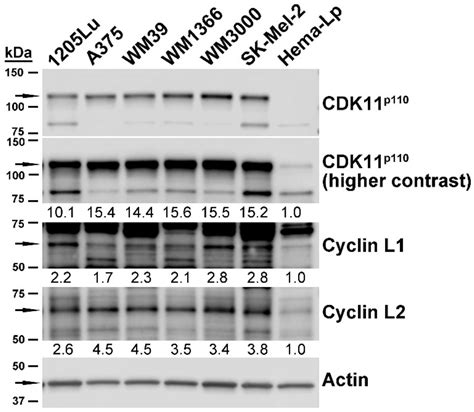 CDK11 Loss Induces Cell Cycle Dysfunction and Death of BRAF and NRAS ... 