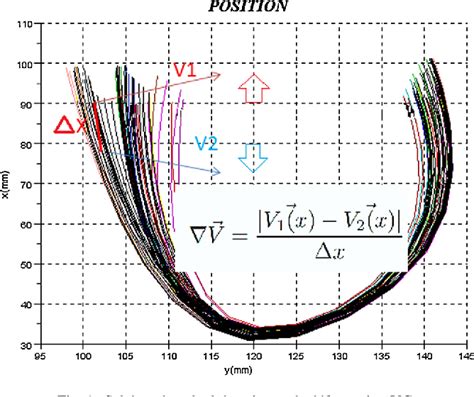 Figure From Performance Et Rendement Du Ventricule Gauche Chez L