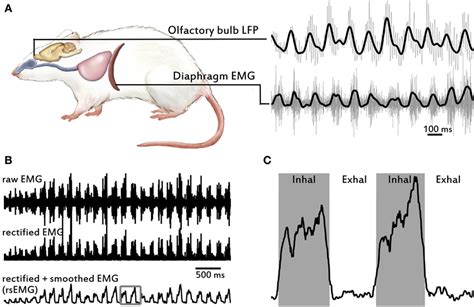 Overview Of Signals Recorded And Emg Processing To Obtain Respiratory