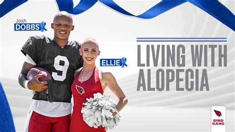 Living With Alopecia Cardinals Qb Josh Dobbs And Cheerleader Ellie