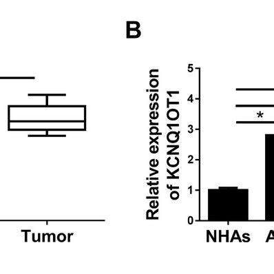 The Expression Of Kcnq Ot Is Increased In Glioma Tissues And Cell