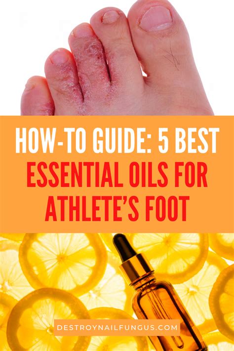 Essential Guide To Top Essential Oils For Athletes Foot