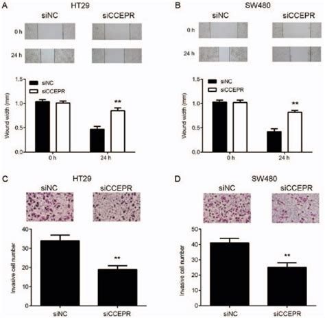 Inhibition Of Ccepr Suppresses Colorectal Cancer Cell Migration And