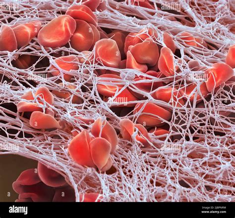 Blood Clot Coloured Scanning Electron Micrograph Sem Of Red Blood