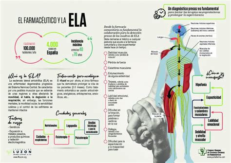 Esclerosis Lateral Amiotrófica ELA Colegio Oficial de Farmacéuticos