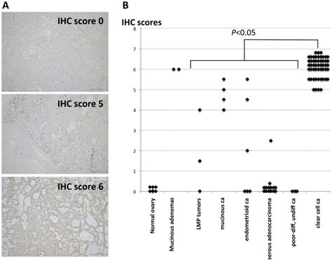 A Representative Images For Anxa Immunohistochemical Ihc Scores