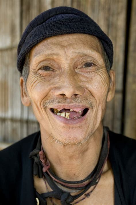 Laughing Old Man With Bad Teeth, Laos Stock Image - Image of asia ...