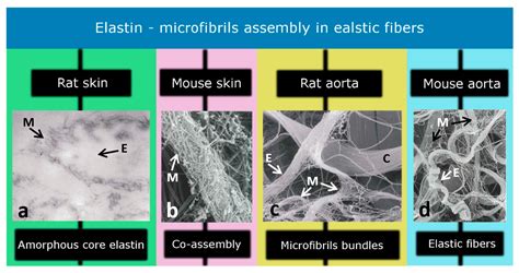 Elastic Fibers