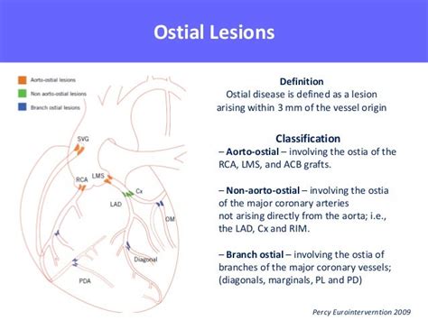 Valeri Gelev - Ostial CTO Lesions