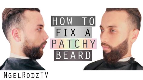 How To Fix A Patchy Beard YouTube