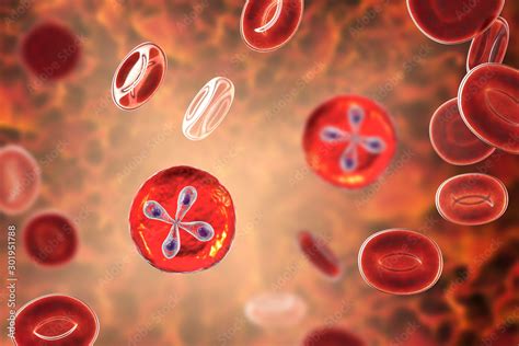 Babesia Parasites Inside Red Blood Cell The Causative Agent Of