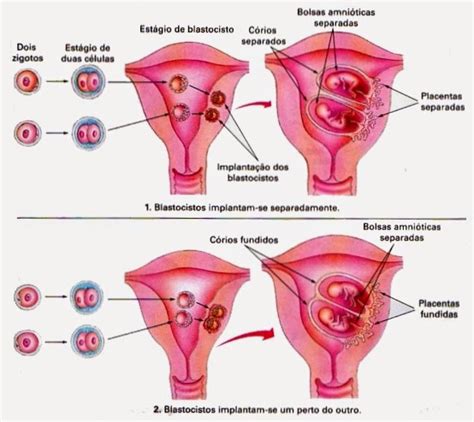 Reprodução Embriologia E Genética Gestação De Gêmeos E Algumas Curiosidades