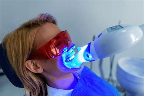 Professional Teeth Whitening Vs At Home Teeth Whitening Drs Batten