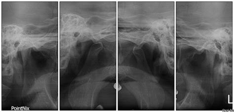 Atm Oral Rx Diagnóstico Radiológico Radiografías Intraorales Radiografías Extraorales