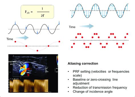 Aliasing Aliasing Is The Major Doppler Artifact It Occurs When Download Scientific Diagram