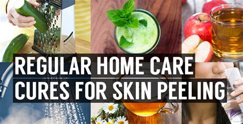 Reasons For Skin Peeling On Hands Home Easy Natural Remedies