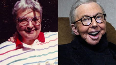 Roger Ebert Before And After