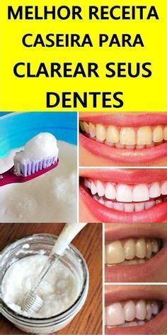 Como Clarear Os Dentes Em Minutos Casca De Banana Aprenda