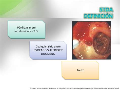 Sangrado Tubo Digestivo Alto Y Bajo Stda