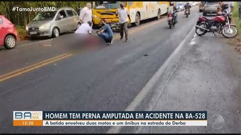 Acidente Motocicletas Deixa Feridos Graves Na BA 528 Em Salvador