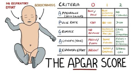 Clin Med Peds Key Questions Flashcards Quizlet