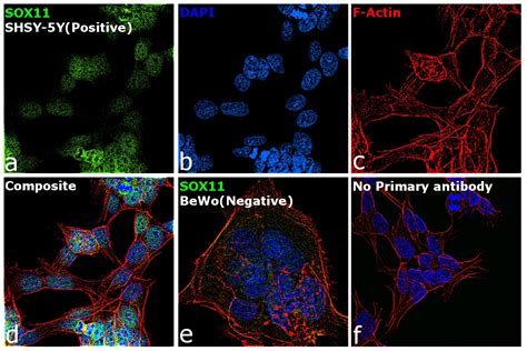 Sox11 Antibody 14 9773 82