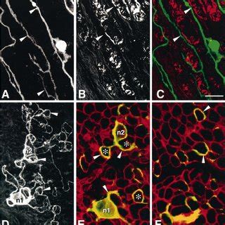 Characterization Of Neurite Outgrowth Of E13 Chick Sensory Neurons