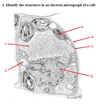 Solved 2 Identify The Structures In An Electron Micrograph