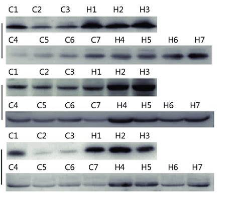 Western Blot Analysis Of Identified Differential Serum Proteins Serum