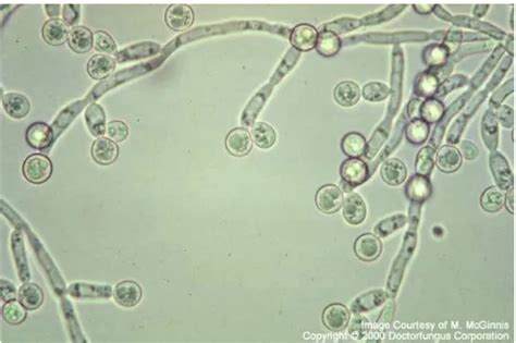 Siembra de Cultivo en agar Harina de Maíz suplementado