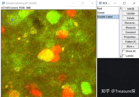 Imagej实用技巧——荧光共标细胞计数解放双手篇 知乎