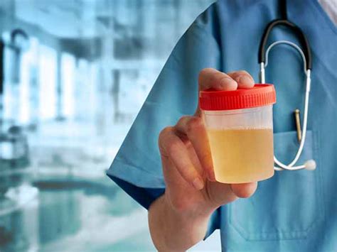 Cloudy Urine Causes Diagnosis And Treatment Boldsky