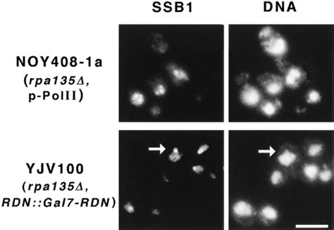 Ifm Analysis Of Nucleolar Structures In Strains Transcribing The