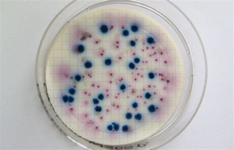 Colony Identifying Bacteria On Agar Plates Pictures In