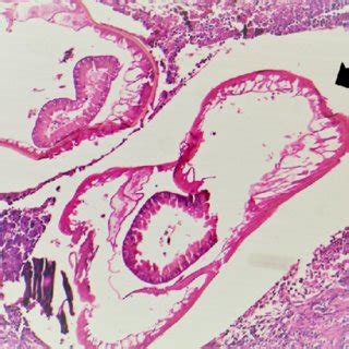 Schematic representation of the life cycle of Spirocerca lupi ...