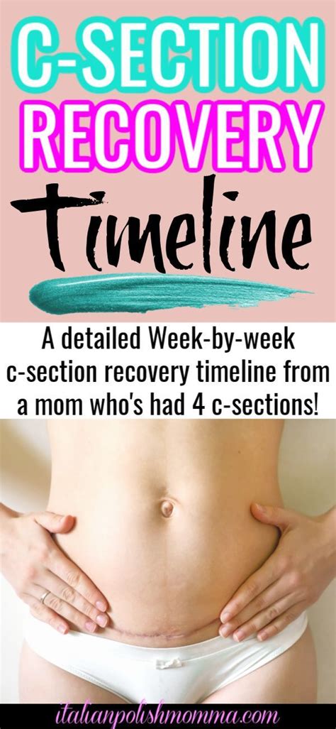 C Section Recovery Timeline Italianpolishmomma C Section