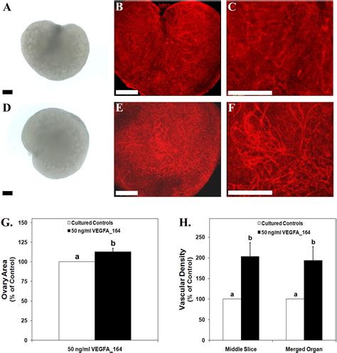 Neutralization Of Vascular Endothelial Growth Factor Antiangiogenic