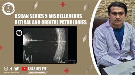 Bscan Series 5 Miscellaneous Retinal And Orbital Pathologies YouTube