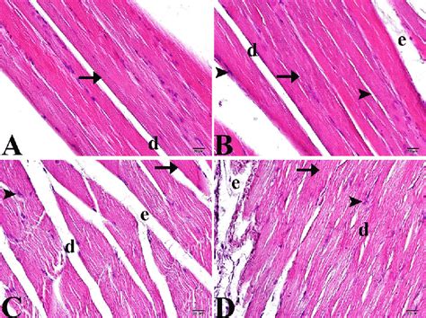 Muscle Cells Under Microscope Labeled