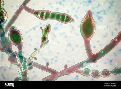 Microsporum audouinii fungus, illustration Stock Photo - Alamy