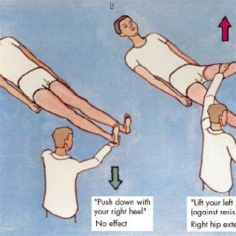 Hoover’s sign. (A) Hip extension is weak when tested directly. (B) Hip ...