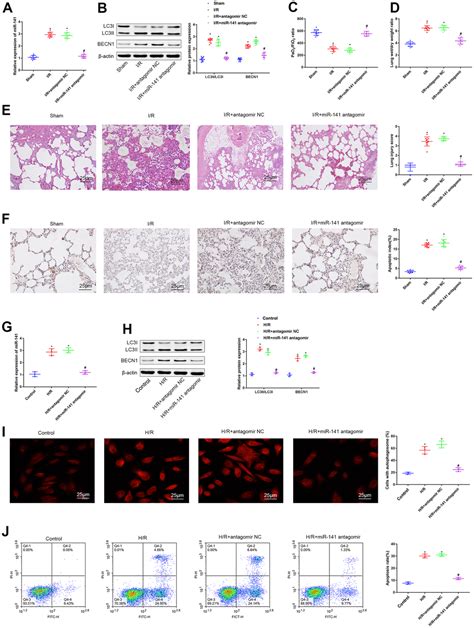 MiR 141 Exacerbates Lung Ischemia Reperfusion Injury By Targeting EGFR