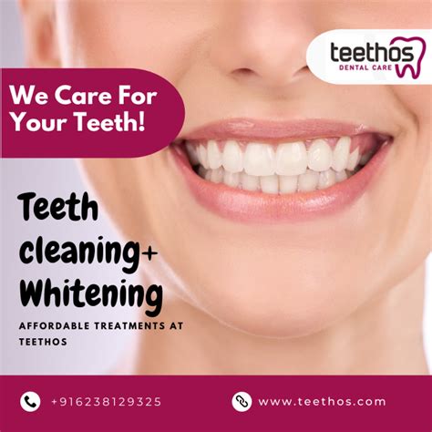 Understanding The Costs Of Teeth Whitening And Cleaning In Kerala