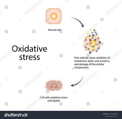 Oxidative Stress Free Radicals Cause Oxidation Stock Vector Royalty Free 2265884245 Shutterstock