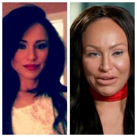 Before And After Larissa 90 Day Plastic Surgery