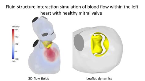 Cardiovascular Simulations And Fluid Dynamics Meduni Vienna