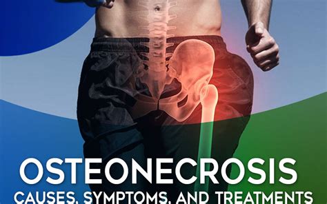 Osteonecrosis Causes Symptoms And Treatments Io Core